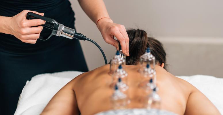 Cupping For Lower Back Pain